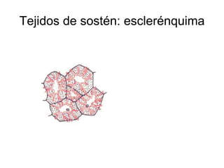 Tejidos de sostén: esclerénquima 