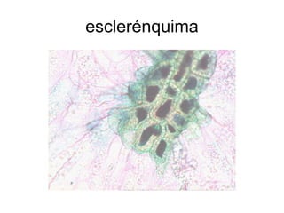 esclerénquima 