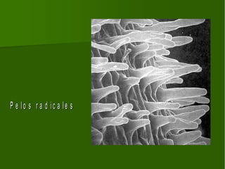 P e lo s r a d ic a le s
 