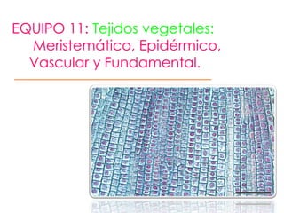 EQUIPO 11: Tejidos vegetales:
  Meristemático, Epidérmico,
  Vascular y Fundamental.
 