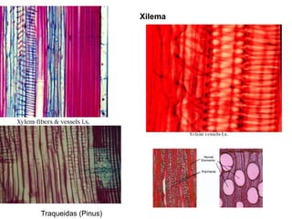 Xilema




Traqueidas (Pinus)
 