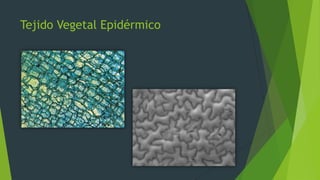 Tejido Vegetal Epidérmico
 