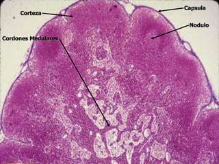 Corteza
Capsula
Nodulo
Cordones Medulares
 