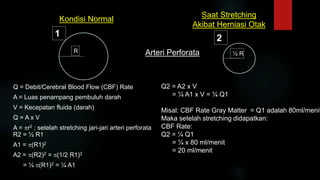 Kondisi Normal
Q = Debit/Cerebral Blood Flow (CBF) Rate
A = Luas penampang pembuluh darah
V = Kecepatan fluida (darah)
Q = A x V
A = r2 ; setelah stretching jari-jari arteri perforata
R2 = ½ R1
A1 = (R1)2
A2 = (R2)2 = (1/2 R1)2
= ¼ (R1)2 = ¼ A1
Saat Stretching
Akibat Herniasi Otak
Arteri Perforata
Q2 = A2 x V
= ¼ A1 x V = ¼ Q1
Misal: CBF Rate Gray Matter = Q1 adalah 80ml/menit
Maka setelah stretching didapatkan:
CBF Rate:
Q2 = ¼ Q1
= ¼ x 80 ml/menit
= 20 ml/menit
R
1
½ R
2
 