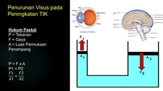 Penurunan Visus pada
Peningkatan TIK
Hukum Paskal
P = Tekanan
F = Gaya
A = Luas Permukaan
Penampang
P = F x A
P1 = P2
𝐹1
𝐴1
=
𝐹2
𝐴2
 
