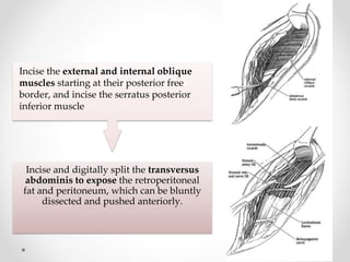 Incise and digitally split the transversus
abdominis to expose the retroperitoneal
fat and peritoneum, which can be bluntly
dissected and pushed anteriorly.
Incise the external and internal oblique
muscles starting at their posterior free
border, and incise the serratus posterior
inferior muscle
 