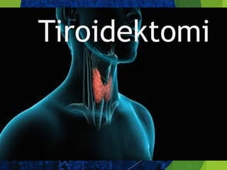 Tiroidektomi
 