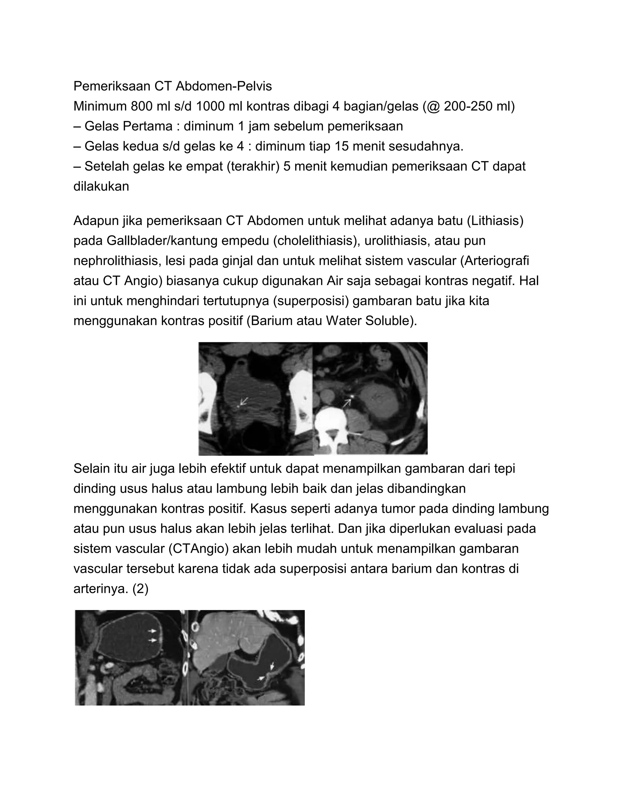 Scan Ember Teknik pemberian oral contrast pada pemeriksaan ct scan abdomen | DOCX