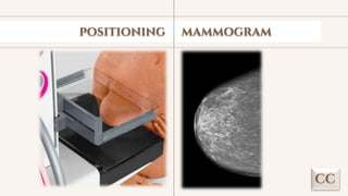 Mammography Positioning Guidebook.pdf TEKNIK PEMERIKSAAN MAMOGRAFI DI RUMAH SAKIT TYPE B.pdf