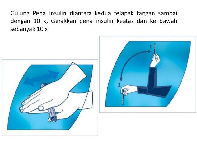 Teknik penyuntikan insulin