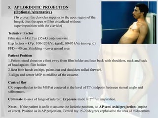 Lindblom Method Teknik radiografi (chest xray) | PPTX