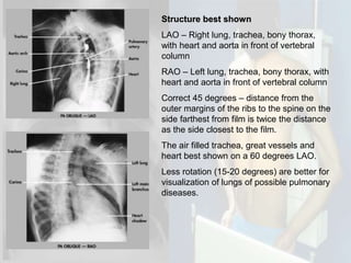 Teknik radiografi (chest xray) | PPTX