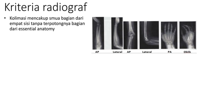 Loopografi Normal Radiologi Teknik Radiografi 3 Pediatric | PPTX