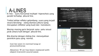 Teknik Radiografi Thoraks.pptx