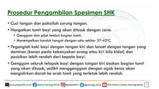 Prosedur Pengambilan Spesimen SHK
• Cuci tangan dan pakailah sarung tangan.
• Hangatkan tumit bayi yang akan ditusuk dengan cara:
• Genggam dan pijat lembut bagian tumit.
• Menempelkan handuk hangat dengan suhu sekitar 37-42oC.
• Peganglah kaki bayi dengan tangan kiri dan lancet dengan tangan yang
dominan (kanan pada kebanyakan orang atau kiri bila kidal) dan
posisikan lebih rendah dari kepala bayi.
• Genggam seluruh telapak bayi dengan tangan kiri sisakan bagian tumit
yang akan ditusuk, sedikit menggenggam dengan agak keras akan
mengalirkan darah ke arah tumit yang terletak lebih rendah.
19
 