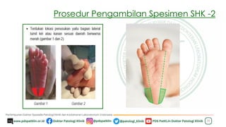 Prosedur Pengambilan Spesimen SHK -2
20
 