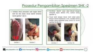 Prosedur Pengambilan Spesimen SHK -2
21
 
