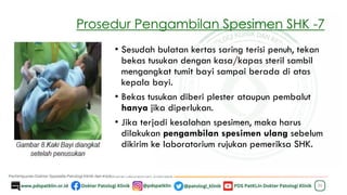 Prosedur Pengambilan Spesimen SHK -7
26
• Sesudah bulatan kertas saring terisi penuh, tekan
bekas tusukan dengan kasa/kapas steril sambil
mengangkat tumit bayi sampai berada di atas
kepala bayi.
• Bekas tusukan diberi plester ataupun pembalut
hanya jika diperlukan.
• Jika terjadi kesalahan spesimen, maka harus
dilakukan pengambilan spesimen ulang sebelum
dikirim ke laboratorium rujukan pemeriksa SHK.
 