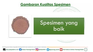 Gambaran Kualitas Spesimen
29
Spesimen yang
baik
 