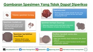 Gambaran Spesimen Yang Tidak Dapat Diperiksa
30
Volume spesimen kurang
Spesimen inadekwat
• Dapat terjadi akibat tumit
bayi ikut menempel pada
kertas saring
Spesimen berlebihan
(overfilled)
• Volume darah yang
diteteskan berlebihan
Supersaturated
• Penetesan darah terlalu banyak di area yang
sama sehingga terbentuk kerutan dan dapat
mempengaruhi hasil
Spesimen berlapis (layering)
• Beberapa tetesan darah pada lokasi yang sama
• Darah diteteskan di kedua sisi kertas saring
Terdilusi, berubah warna atau
terkontaminasi
• Dilusi atau hemolisis dapat disebabkan oleh alkohol
atau air
• Pastikan tumit bayi dalam keadaan bersih sebelum
pengambilan spesimen
 