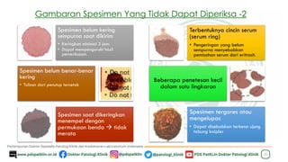 31
Spesimen belum kering
sempurna saat dikirim
• Keringkan minimal 3 jam.
• Dapat mempengaruhi hasil
pemeriksaan.
Spesimen belum benar-benar
kering
• Tulisan dari penutup tercetak
Spesimen saat dikeringkan
menempel dengan
permukaan benda → tidak
merata
Terbentuknya cincin serum
(serum ring)
• Pengeringan yang belum
sempurna menyebabkan
pemisahan serum dari eritrosit.
Beberapa penetesan kecil
dalam satu lingkaran
Spesimen tergores atau
mengelupas
• Dapat disebabkan terkena ujung
tabung kaipler
Gambaran Spesimen Yang Tidak Dapat Diperiksa -2
 