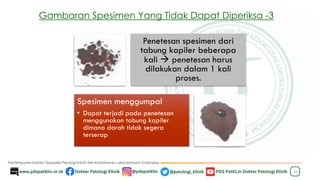 32
Penetesan spesimen dari
tabung kapiler beberapa
kali → penetesan harus
dilakukan dalam 1 kali
proses.
Spesimen menggumpal
• Dapat terjadi pada penetesan
menggunakan tabung kapiler
dimana darah tidak segera
terserap
Gambaran Spesimen Yang Tidak Dapat Diperiksa -3
 