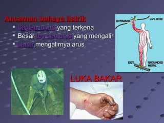 Ancaman bahaya listrikAncaman bahaya listrik

Bagian tubuhBagian tubuh yang terkenayang terkena

BesarBesar teg dan arusteg dan arus yang mengaliryang mengalir

LamaLama mengalirnya arusmengalirnya arus
LUKA BAKARLUKA BAKAR
 