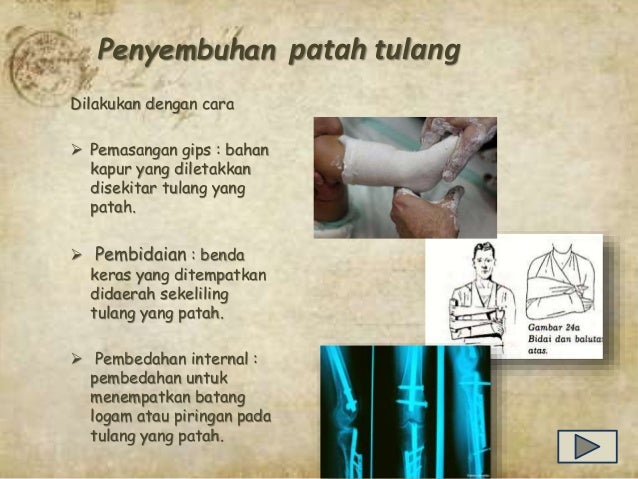  Teknologi  yang berkaitan dengan sistem  gerak 