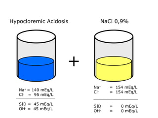 Na +  = 140 mEq/L Cl -   =  95 mEq/L SID =  45 mEq/L OH -  =  45 mEq/L + Hypocloremic Acidosis Na +  =  154 mEq/L Cl -   =  154 mEq/L SID  =  0 mEq/L OH -   =  0 mEq/L NaCl 0,9% 