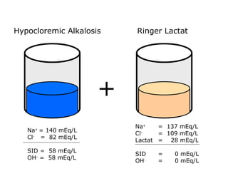 Na +  = 140 mEq/L Cl -   =  82 mEq/L SID =  58 mEq/L OH -  =  58 mEq/L + Hypocloremic Alkalosis Na +  =  137 mEq/L Cl -   =  109 mEq/L Lactat  =  28 mEq/L SID  =  0 mEq/L OH -   =  0 mEq/L Ringer Lactat 