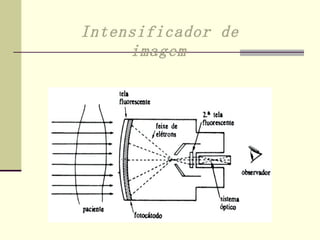Intensificador de imagem   