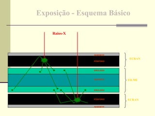 Exposição - Esquema Básico   SUPORTE SUPORTE SUPORTE EMULSÃO EMULSÃO FÓSFORO FÓSFORO Raios-X FILME ECRAN ECRAN 
