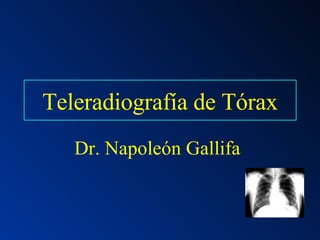 Teleradiografía de Tórax Dr. Napoleón Gallifa 
