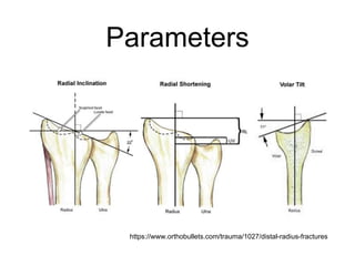 Parameters
https://www.orthobullets.com/trauma/1027/distal-radius-fractures
 