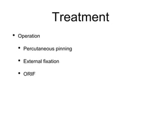 Treatment
• Operation
• Percutaneous pinning
• External fixation
• ORIF
 