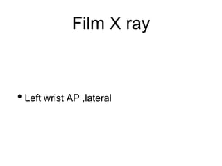 Film X ray
• Left wrist AP ,lateral
 