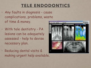 TELE ENDODONTICS
• Any faults in diagnosis - cause
complications, problems, waste
of time & money.
• With tele dentistry - PA
lesions can be adequately
assessed - help to devise
necessary plan.
• Reducing dental visits &
making urgent help available.
 