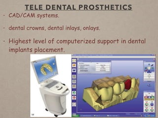 TELE DENTAL PROSTHETICS
• CAD/CAM systems.
• dental crowns, dental inlays, onlays.
• Highest level of computerized support in dental
implants placement.
 