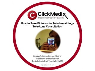 How to Take Pictures for Teledermatology
        Tele-Acne Consultation




         (Images/information provided in
            this section are courtesy of
        Dr. Achaimah Osei-Tutu, MD, FAAD)
                 http://clickmedix.com
 