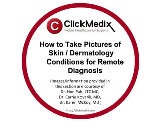 How to Take Pictures of
  Skin / Dermatology
 Conditions for Remote
        Diagnosis
  (Images/information provided in
     this section are courtesy of
        Dr. Hon Pak, LTC MC,
       Dr. Carrie Kovarik, MD,
       Dr. Karen McKoy, MD )
          http://clickmedix.com
 