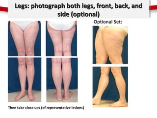 Legs: photograph both legs,title style and
           Click to edit Master  front, back,
                   side (optional...