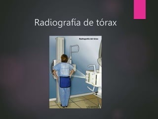 Radiografía de tórax
 