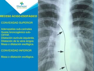 Radiología del Aparato Respiratorio | PPTX