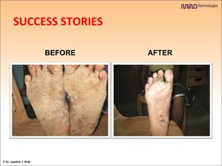 BEFORE AFTER SUCCESS STORIES ©  Dr. Jawahar J. Shah 
