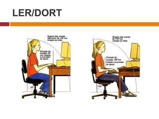 LER/DORT
 