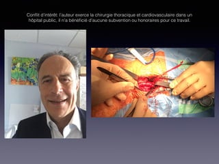 Conﬂit d’intérêt: l’auteur exerce la chirurgie thoracique et cardiovasculaire dans un
hôpital public, il n’a bénéﬁcié d’aucune subvention ou honoraires pour ce travail.
 