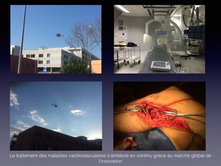 Le traitement des maladies cardiovasculaires s’améliore en continu grace au marché global de
l’innovation
 