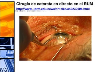 Cirugía de catarata en directo en el RUM
http://www.uprm.edu/news/articles/as0232004.html
 