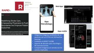 Apps mobile
Web Apps
Apps
Teleradiología
• Integra las imágenes cerebrales de un
paciente con un ICTUS con IA/machine
learning
• Establece el ASPECT SCORE
• Soporte de decisión para neurólogo y
RX intervencionista
• Comparte imágenes en remoto con los
actores implicados
 