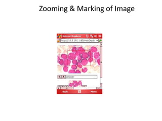 Zooming & Marking of Image
 